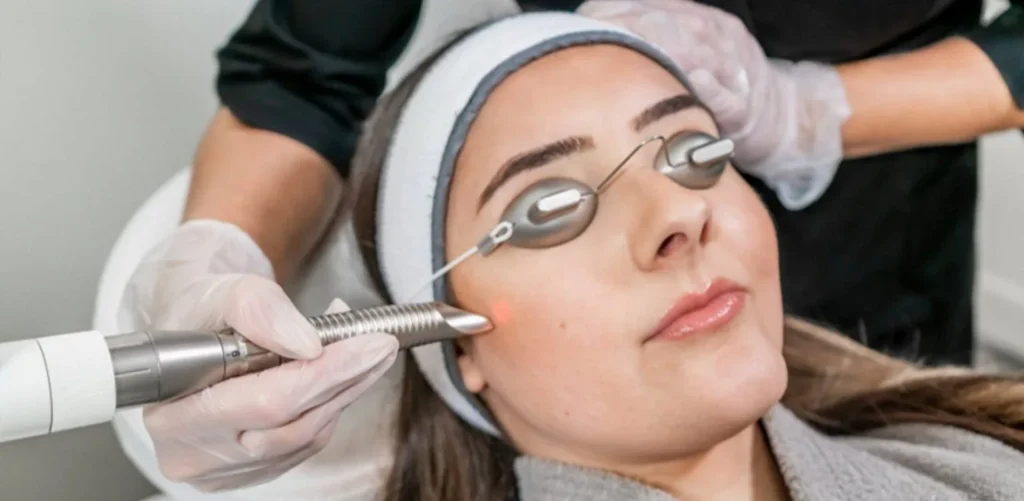 Laser Toning 2 girl taking laser treatment on her face
