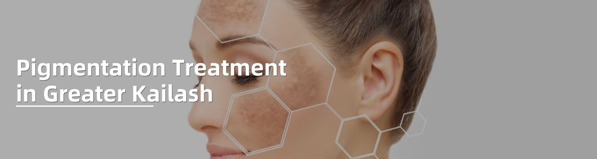 Pigmentation Treatment in Greater Kailash 1 pigmentation treatment removal in delhi