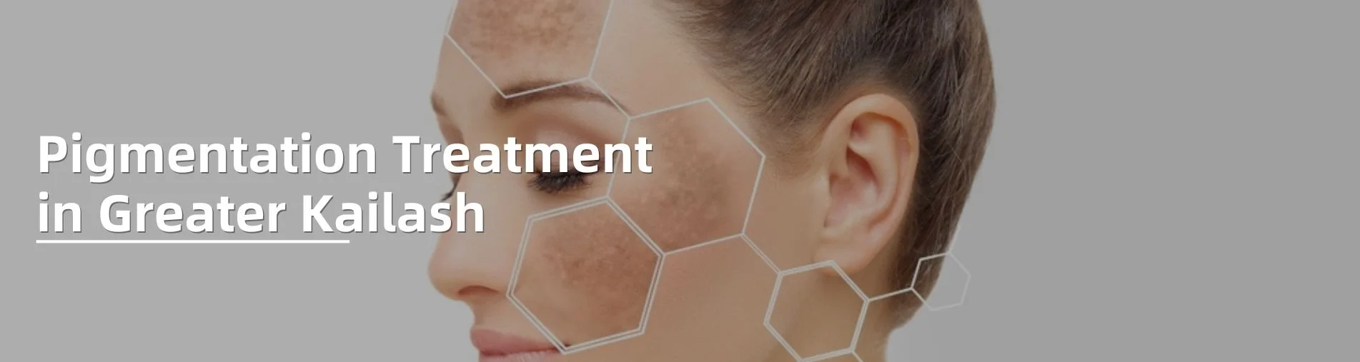 pigmentation treatment removal in delhi