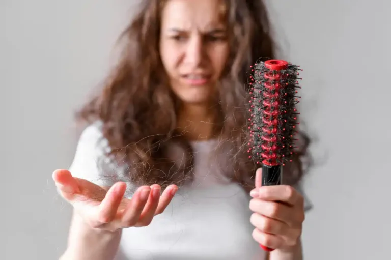 Read more about the article Understanding Hair fall: Causes and Effective Treatments