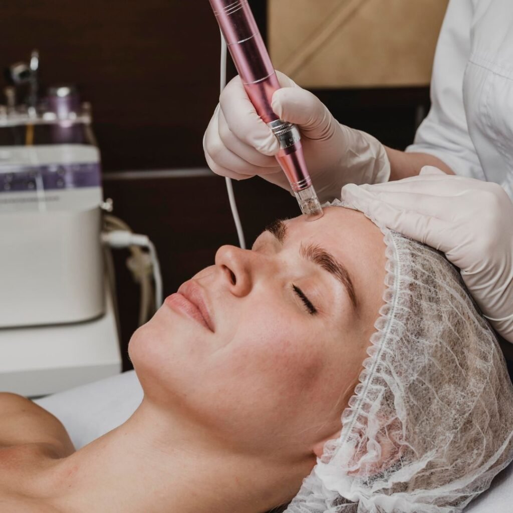 Dermapen 4 Treatment in Greater Kailash 2 Dermapen 4 Treatment