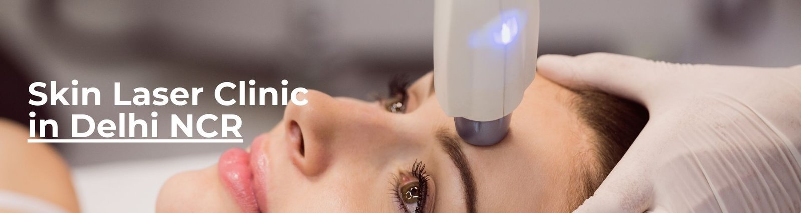 Skin laser clinic in delhi NCR