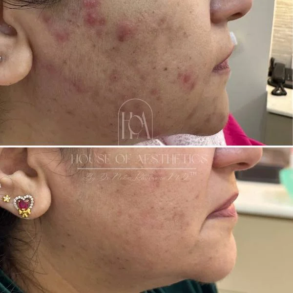 best dermatologist treatment in south delhi