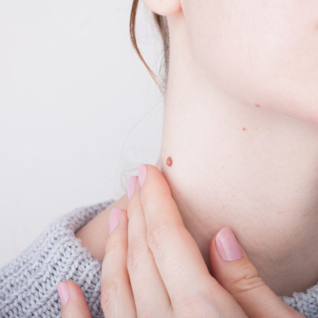 Warts and Mole Clinic in Greater Kailash 2 warts and mole clinic