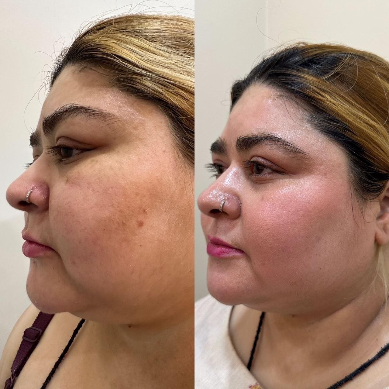 Warts and Mole Clinic in Greater Kailash 5 WhatsApp Image 2024-11-22 at 19.21.57