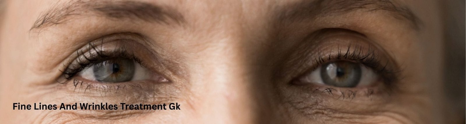 Fine Lines And Wrinkles Treatment Gk