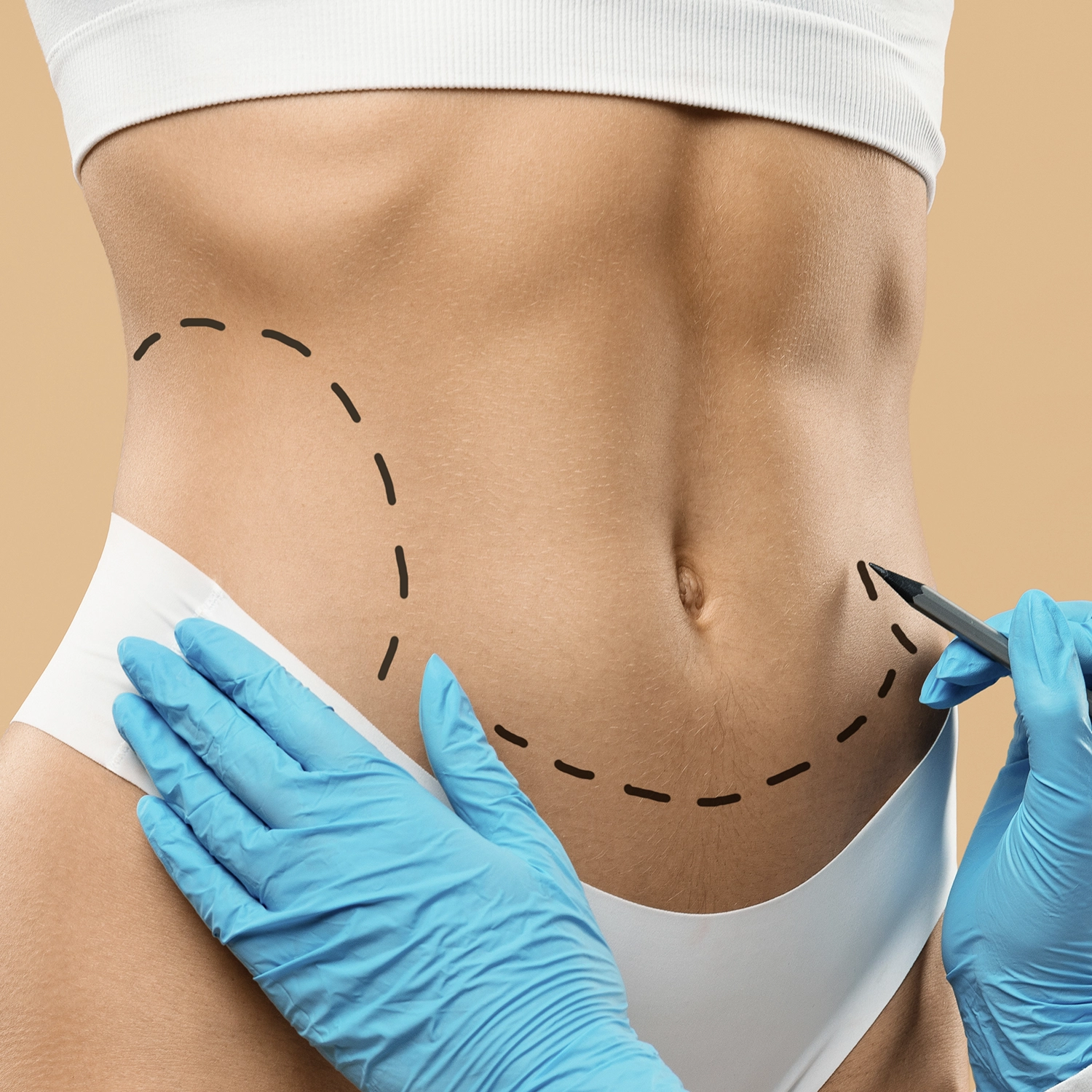 Lipolysis Injections at HOA Body Lab Lipolysis Injections for Fat Reduction at HOA Clinic Delhi