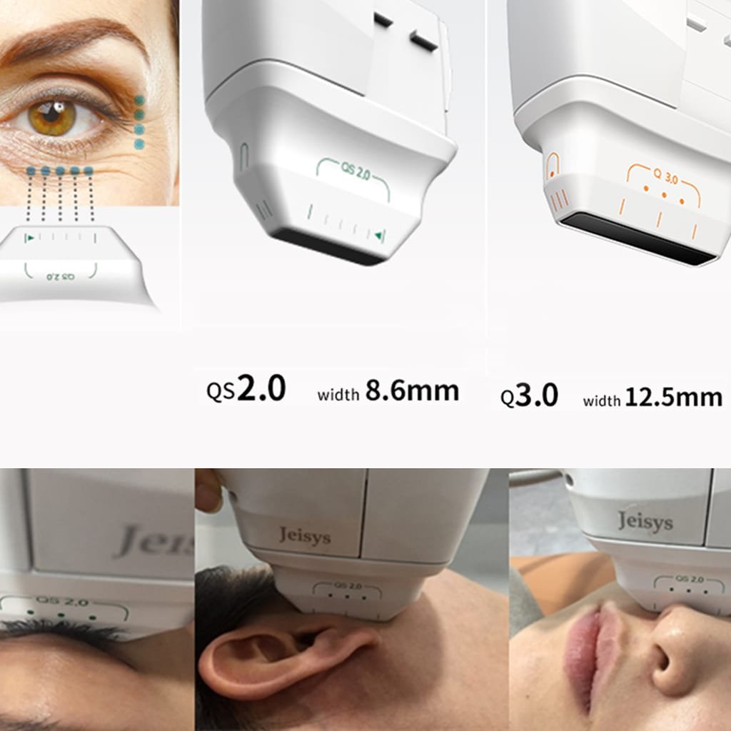 Hifu Treatment in South Delhi