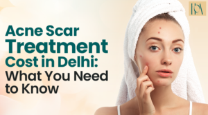 Read more about the article Acne Scar Treatment Cost in Delhi: What You Need to Know
