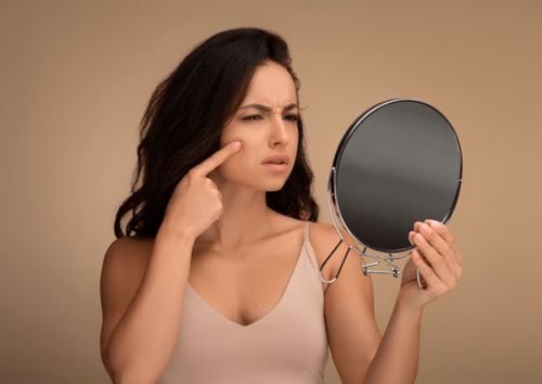 Best Treatment For Acne Acne Scars In Delhi