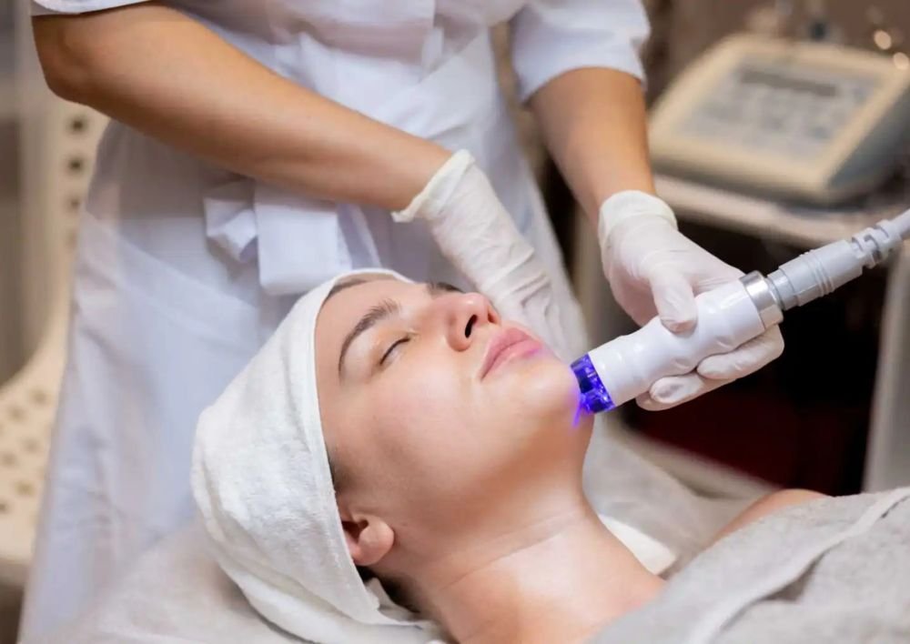 Best Treatment For Acne Acne Scars In Delhi