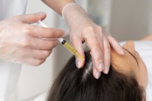 Read more about the article PRP Hair Therapy in Delhi: Cost, Sessions Needed, and Realistic Results